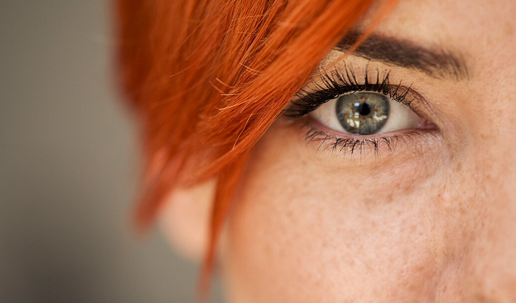 Eye health
